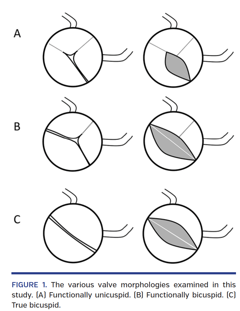 Aortic Valve Morphology Correlates With Left Ventricular Systolic